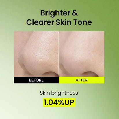 This luxurious Korean Mung Bean Complete Cleansing Set is displayed in a vibrant, nature-inspired scene that highlights its clean-beauty purity and premium botanical origins. The radiant Mung Bean Cleansing Oil stands on the left with a golden-green glow, while the pH-balanced Mung Bean Cleansing Foam rises tall beside it, embodying advanced Korean deep-cleansing innovation. In front, the rich Mung Bean Pore Clay Mask showcases its detoxifying green texture. Modern Korean Skincare, acne fighter.